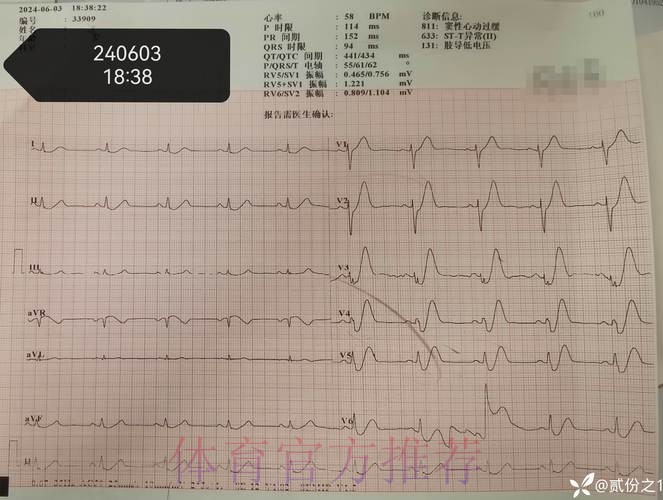 莫德里奇出现发烧症状 经检查已排除新冠感染 莫德里奇出现发烧症状 经检查已排除新冠感染